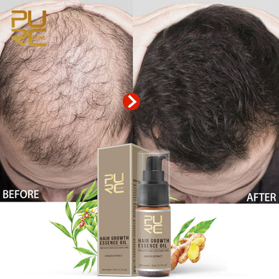 PURC Hair Growth Serum Oils Fast Hair Growth Products Hair